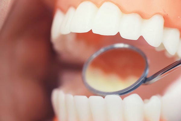 Signs You May Need A Dental Deep Cleaning