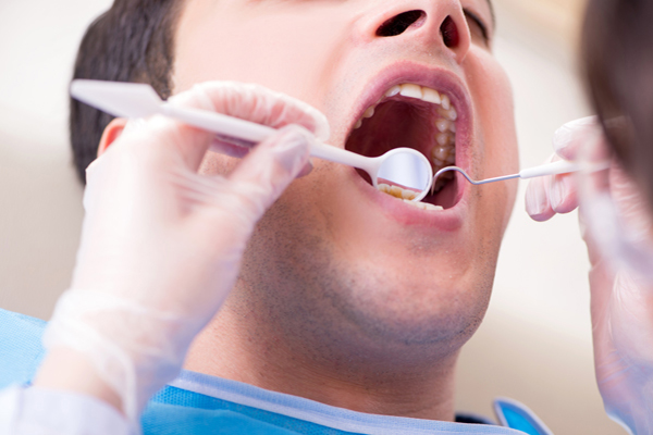 Dental Sealant Treatment From Your General Dentist