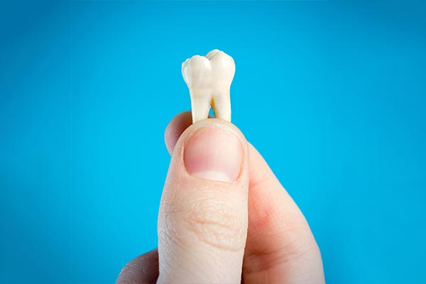 A General Dentist Helps You Decide Whether To Pull or Save a Tooth from Salud Dental Group in Albuquerque, NM
